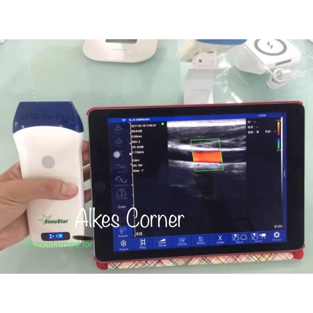 USG wireless  / Probe wireless dengan aplikasi IOS dan Android