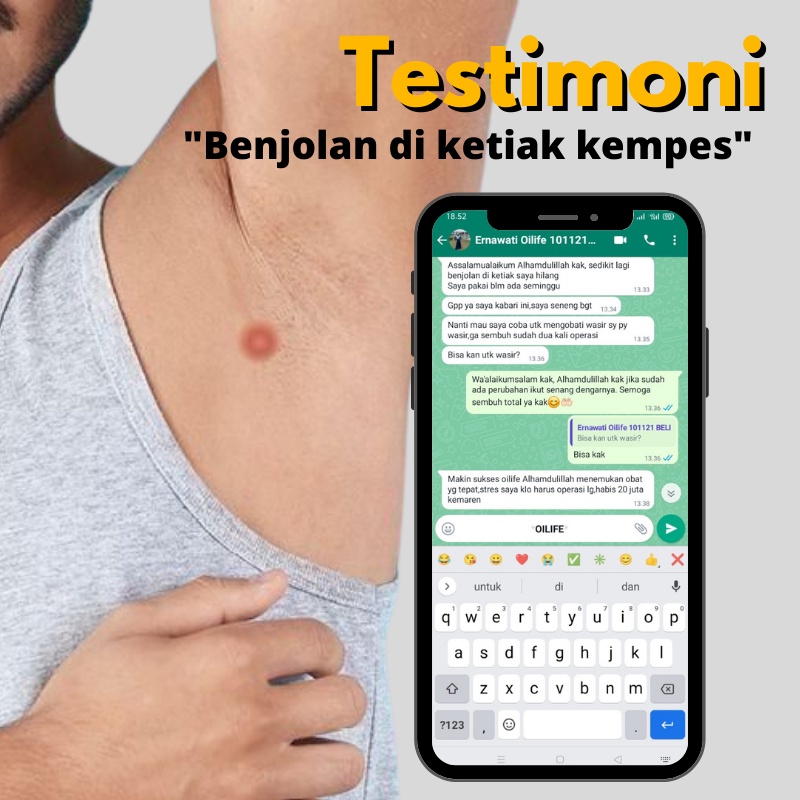 OILIFE Obat Benjolan di Ketiak / Herbal Benjolan di Ketiak