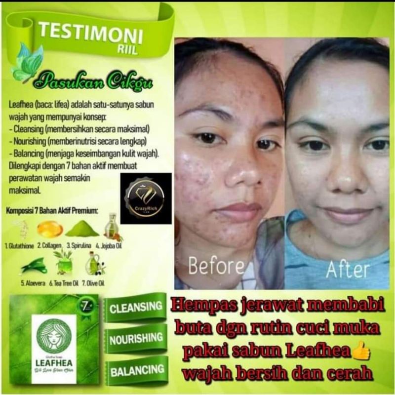 SABUN LEAFHEA ORIGINAL/LEAFHEA GLUTA SOAP/SABUN WAJAH