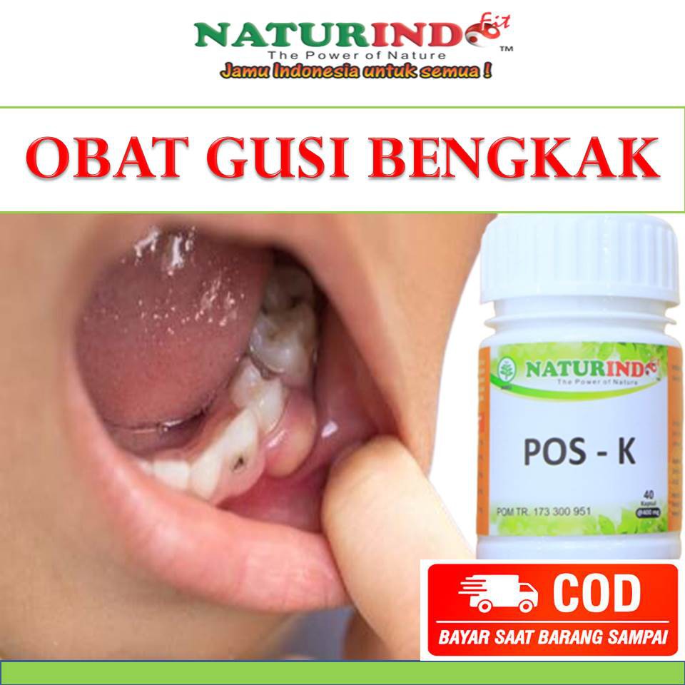 obat untuk gusi nyeri dan bengkak di malaysia