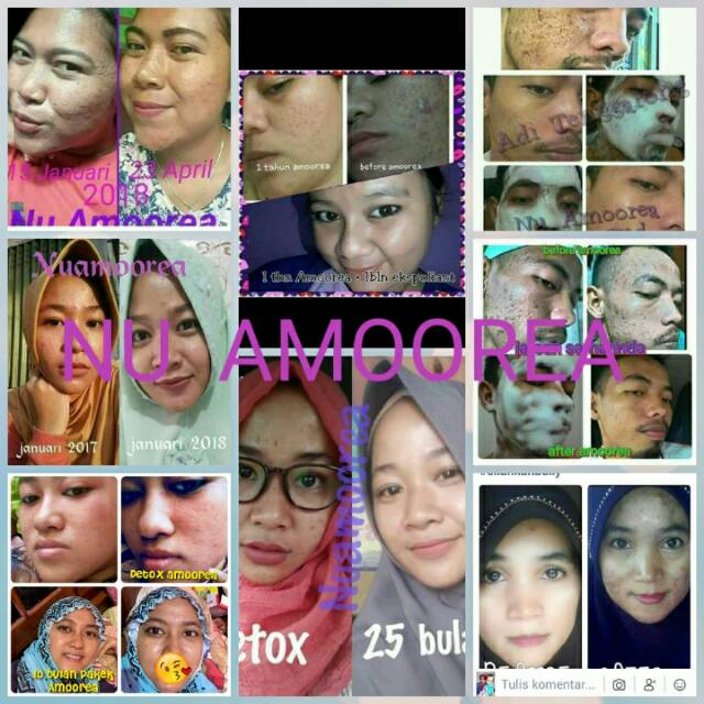 Paket perawatan kecantikan premium Khusus KULIT BERMINYAK Nu Amoorea Beauty Series Lengkap Hemat