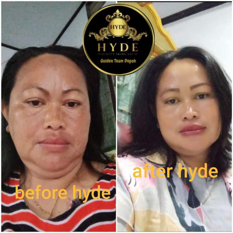 Hyde beauty skincare Facial Wash | Serum lemon | Night Cream | Day Cream