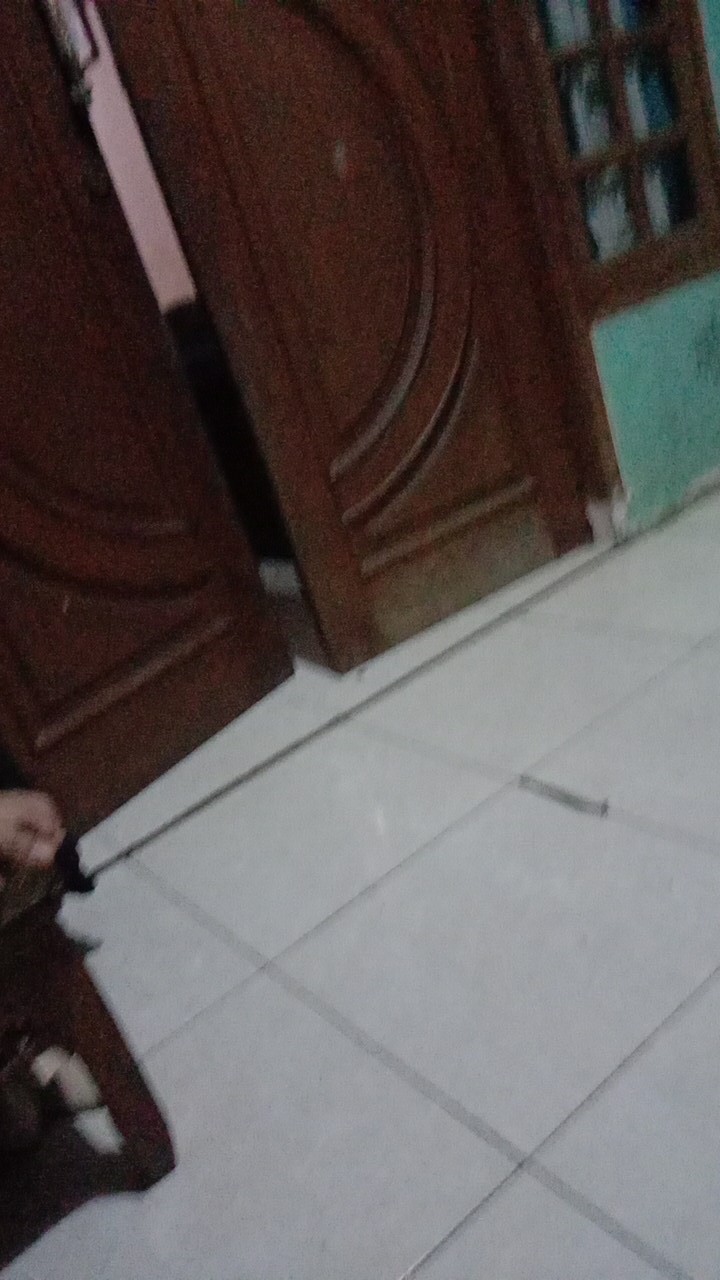 Face Shield [stock]nopeet Acrylic Full Face Shield Visor Faceshield Face Sheild Sunglasses Sun Goggles Furn