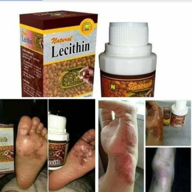 

Natural lecithin