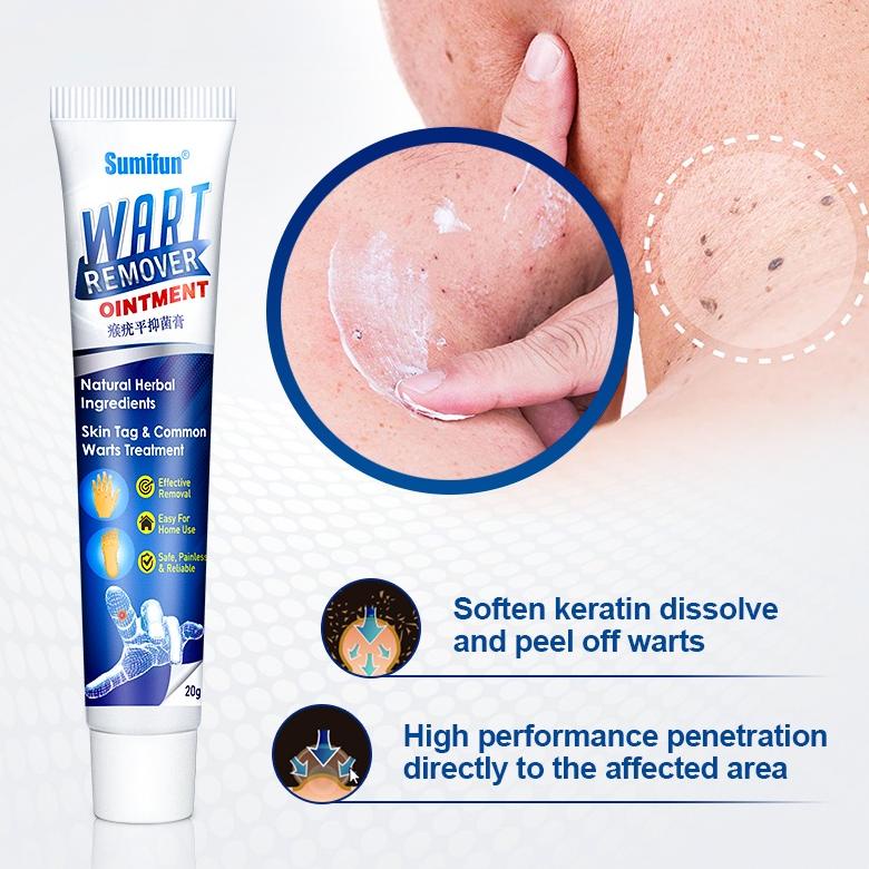 Warts Remover Cream Wart Treatment Skin Tags Mole Remover Plaster Cream Antibacterial Foot Wart Oint