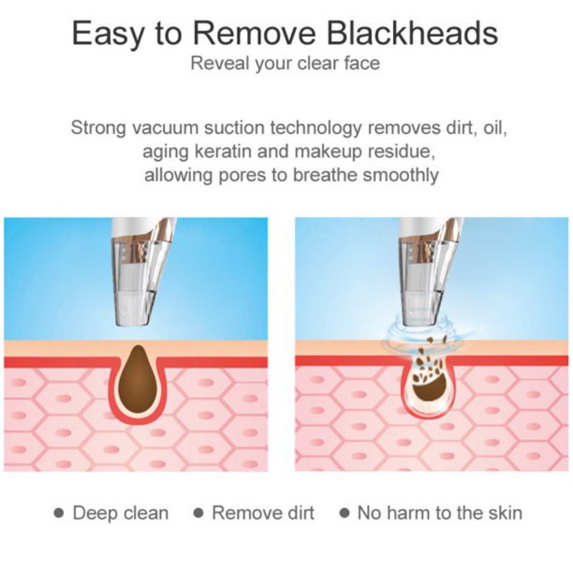 BISA COD - Alat Penyedot Komedo dan Jerawat - Vakum Komedo /Alat Komedo Facial /Alat Sedot Komedo