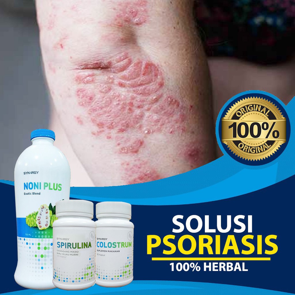 

Herbal Atasi Gatal Kulit Kering Bersisik - Solusi Ampuh Obati Kulit Mudah Terkelupas Psoriasis BPOM