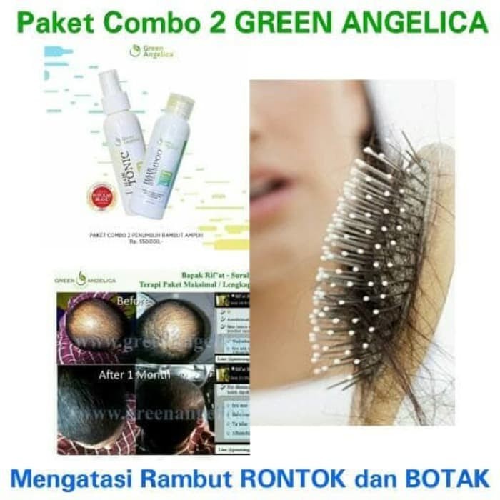 Paket Green Angelica Penipisan Rambut Ringan Obati Rambut Rontok