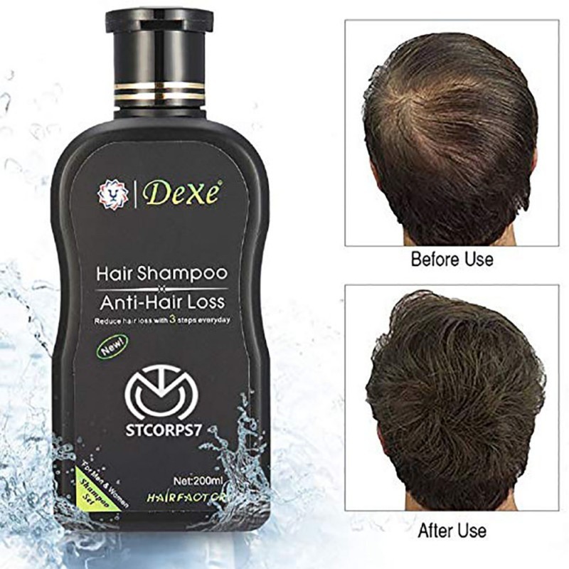 Xiaozgant Id Shampoo Rambut Herbal Natural Anti Rambut Rontok