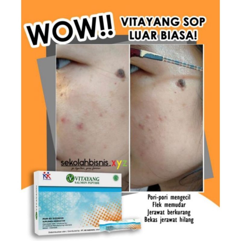 Vitayang SOP Salmon Ovary Peptide Minuman Kecantikan dari Jepan Menghilangkan Flek jerawat Mencerahkan wajah Suplemen Kesehatan Collagen Original KK Indonesia