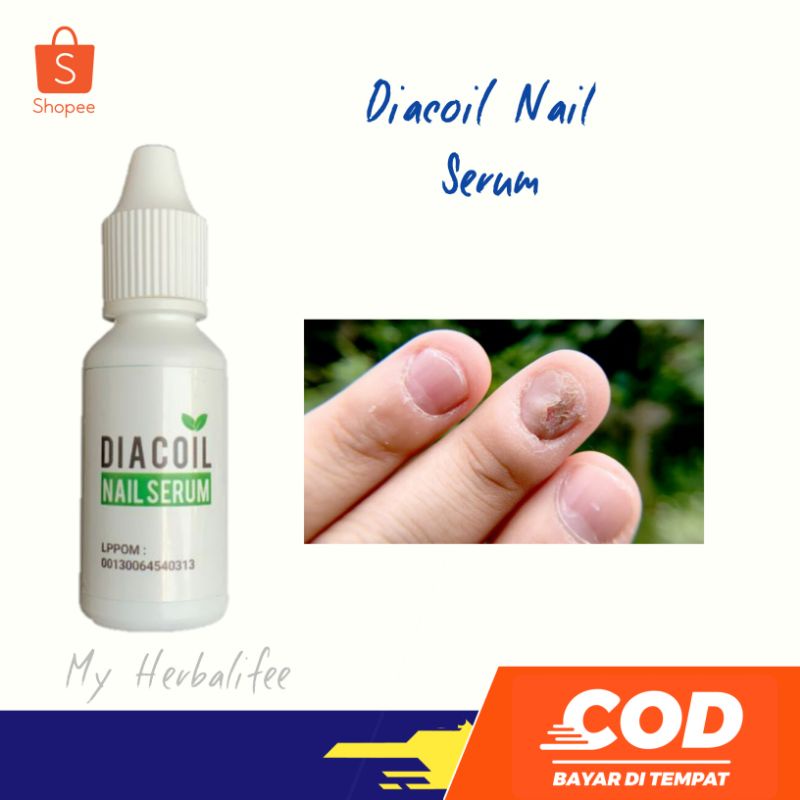 vtxbps- [COD] DIACOIL NAIL SERUM OBAT KUKU RUSAK PENGHILANG JAMUR KUKU