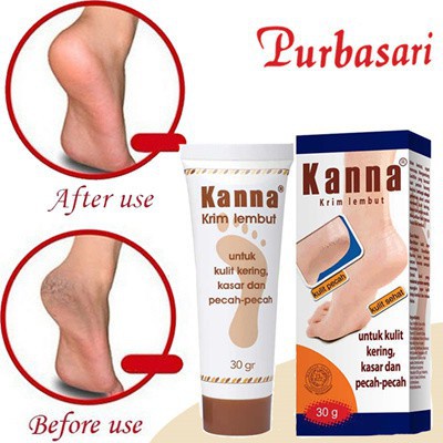 Kanna Cream Tube/ Krim kaki/ Cracked Heel Cream/ Krim White/ Krim Soft Lembut 15 gr/30 gr