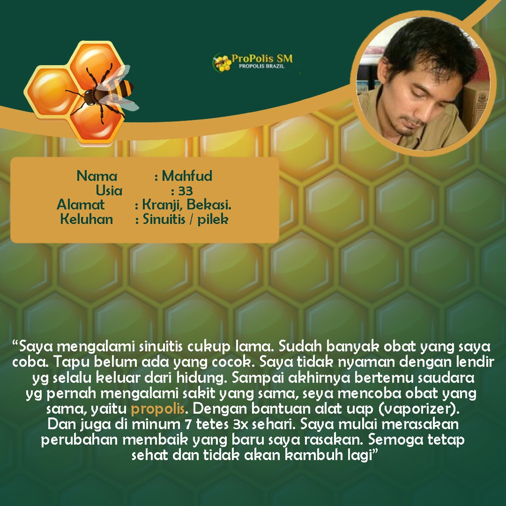 Obat Tetes Sinusitis Akut Kronis Gejala Sinusitis Untuk Anak &amp; Dewasa Propolis SM Original