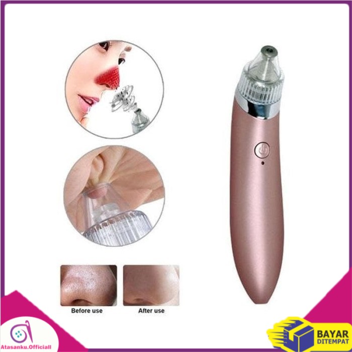 Alat Penyedot komedo Untuk untuk menghilangkan komedo hidung AMPUH