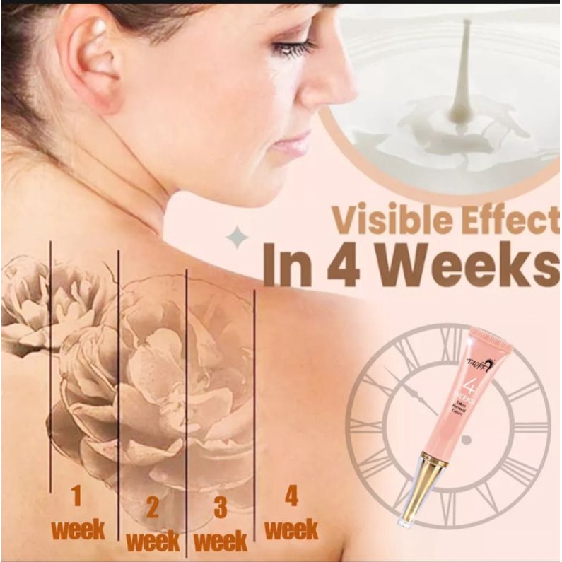 PENGHILANG TATO TANPA RASA SAKIT CEPAT PUDAR