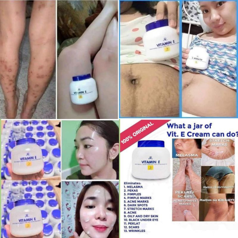 AR VITAMIN E lotion cream Moisturizing pemutih kulit lembab atasi flek bekas luka stretchmarks bekas