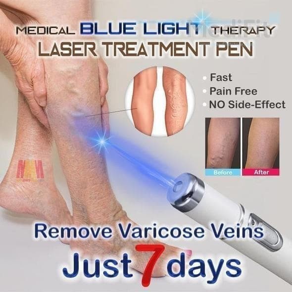 LASER PEN TREATMENT TEKNOLOGI CAHAYA BIRU 415MM