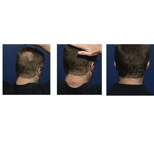 ☼ OCARE HAIR BUILDING FIBER REFILL 57g HITAM / RAMBUT ANTI BOTAK - Black, 25g ☀