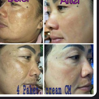 SEPAKET CREAM CM CUCOK CREAM MEONG KRIM IMELDA YUNUS KOSMETIK krim CM CUCO MEONG PERAWATAN SKINCARE