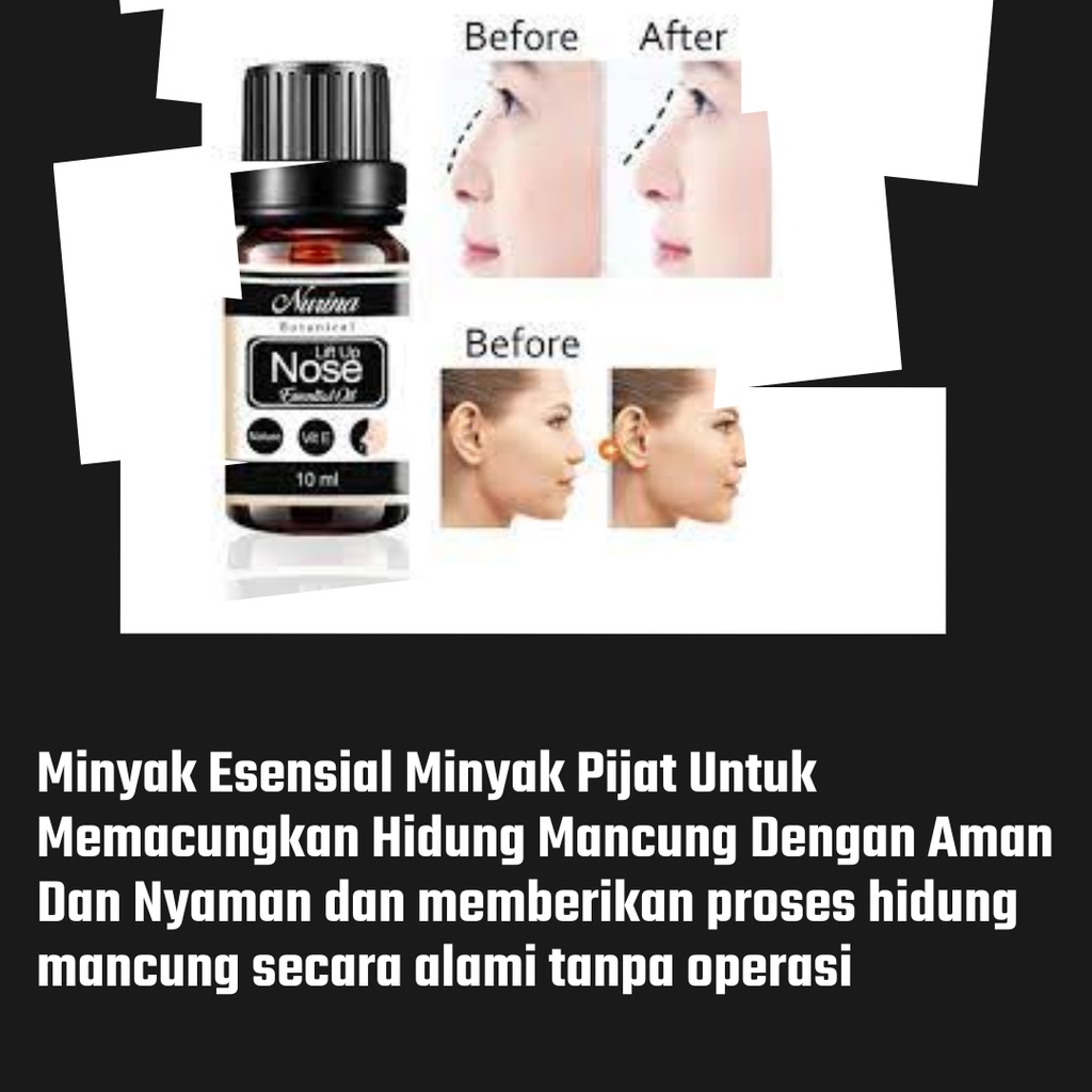 Alat Obat Minyak Pemancung Memancungkan Hidung Permanen Mancung Alami Pria Dan Wanita Ampuh Nose Up Lift Essential Oil Serum 10 Ml Penjepit Pengecil Hidung Besar Kecil 100% Original