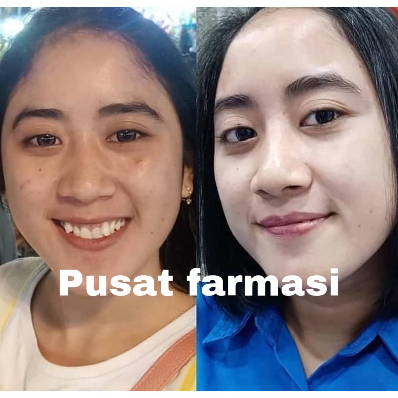 PAKET WHITENING WAJAH | PAKET USAHA