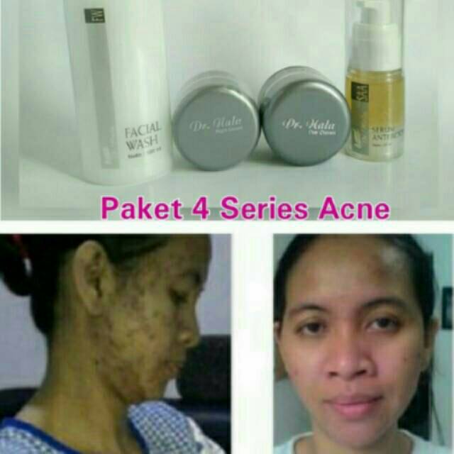 Dr.Nala whitening cream paket 4 series