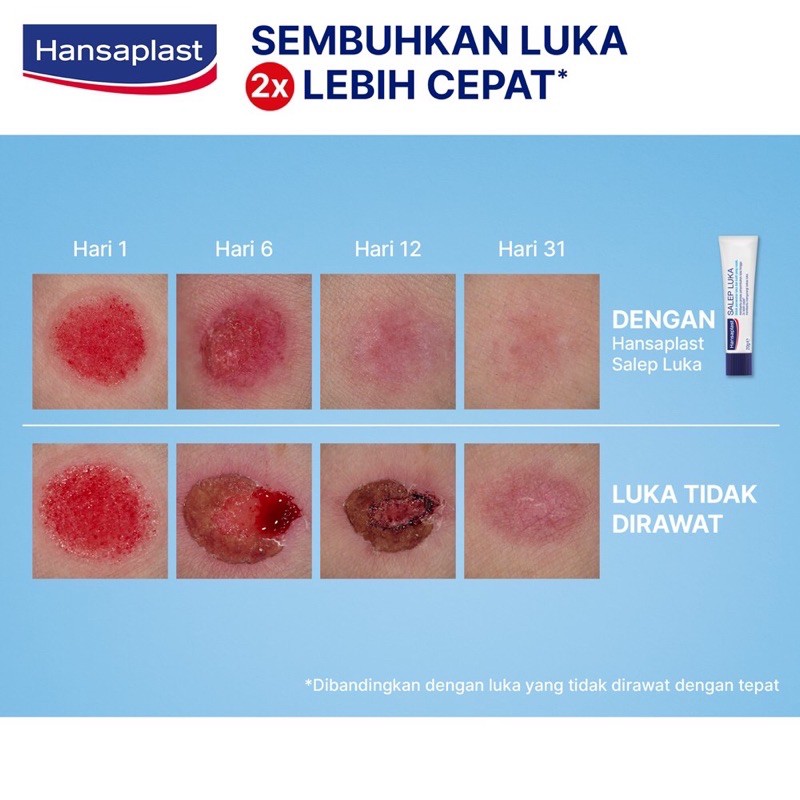 Hansaplast Wound Care Ointment 3.5gr 20gr - Hansaplast Salep Luka - Hansaplas Salep Luka Bakar, Luka Sunat, Luka Robek