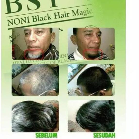 ♀ Asli BSY Noni ORI/Shampo Noni/Menghitamkan Rambut ♗