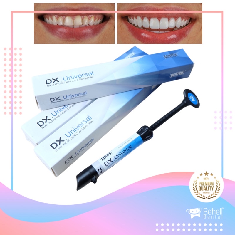 COMPOSITE DENTEX VENEER DX A1 A2 A3 A3.5 - Dental Bahan Direct Veneers Gigi Kelinci Komposit - Lem Gigi Kelinci - Bahan Tambal Tambalan Penambal Gigi Permanen - Behelldental