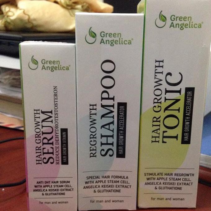 superpromo Perawatan Rambut Rontok dan Botak Alami Green Angelica