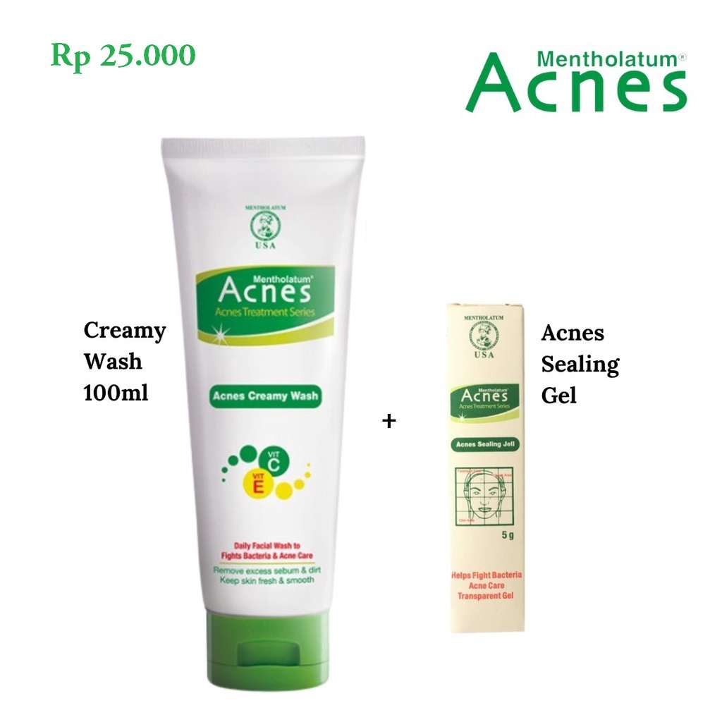 Acnes Creamy Wash Foaming Washing Bar 50g 80g 100g-Sabun cuci muka anti jerawat badan (VH)