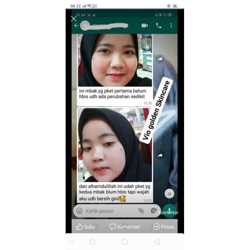 Vio golden skincare Ultimate series