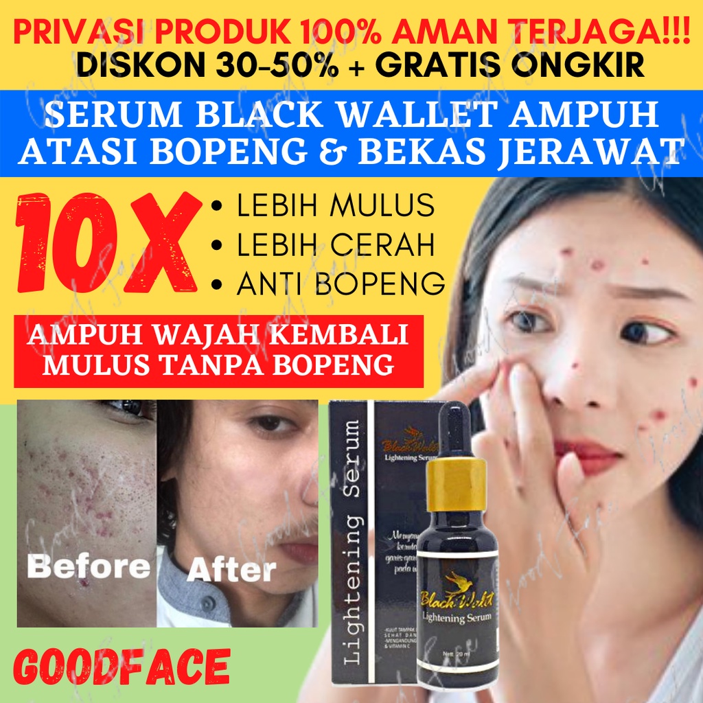 BLACK WALET LIGHTENING SERUM ORIGINAL BPOM PENGHILANG FLEK WAJAH