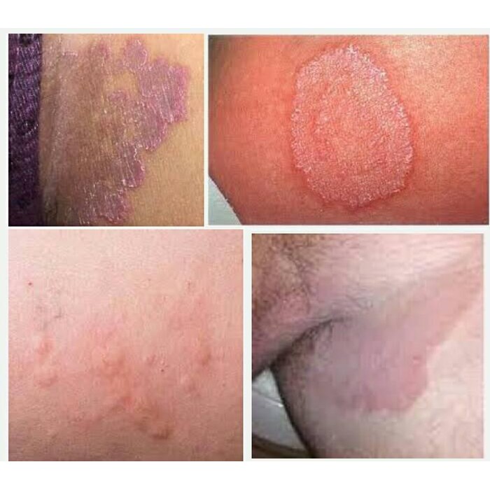 SALEP KULIT BL SHINSEI CHAN ORIGINAL