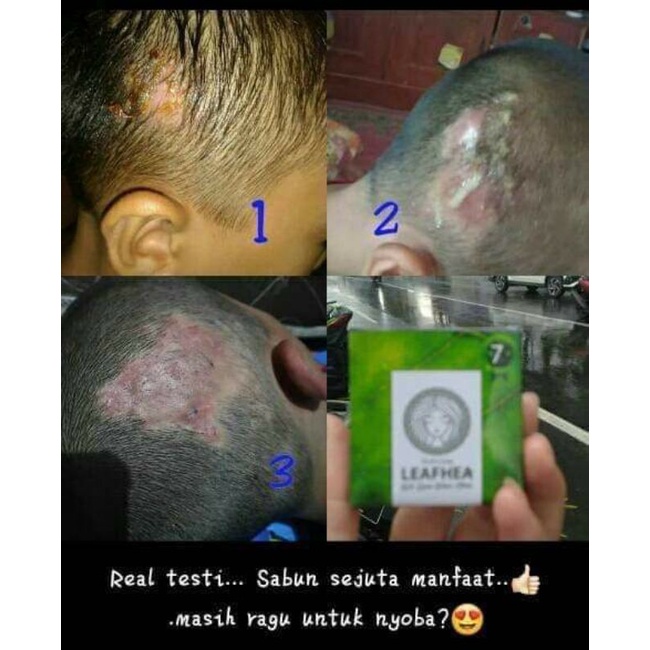 sabun dan serum LEAFHEA