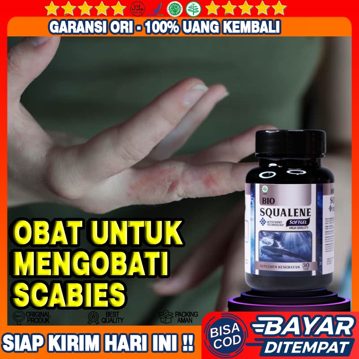 Obat Scabies Manusia - Obat Borok Budug - Obat Budug - Obat Gatal Budug - Obat Penghilang Bekas Budu