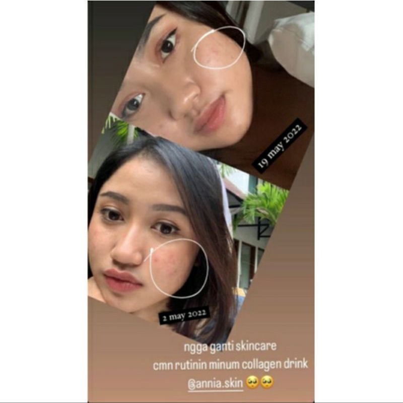 ANNIA COLLAGEN DRINK / MINUMAN COLLAGEN DRINK / ANNIA COLLAGEN PENCERAH KULIT