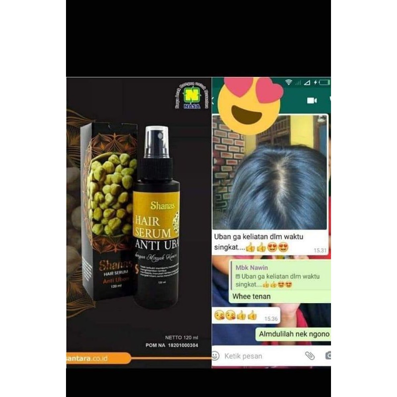 Hair Serum Anti Uban