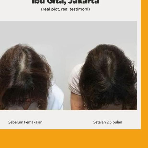 Event [7.7] AVALIN PAKET Hair Growth Serum Oil + Hair Grow Shampoo (Hair Treatment Rambut Lembut Leb