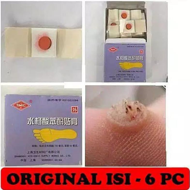 Plester Kutil Mata Ikan Kapalan Original Isi 6 Psc