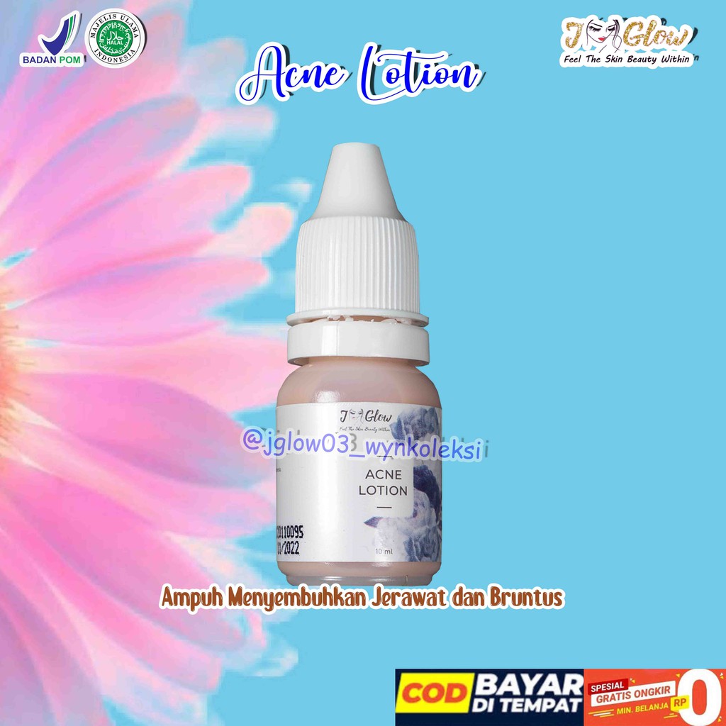 Jual Acne Lotion JGlow Sulfur JGlow Obat Jerawat JGlow Ciruas JGlow