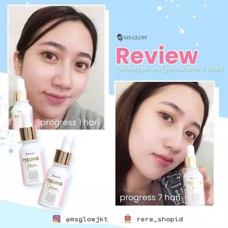 MS glow peeling serum / peeling serum MS glow / serum MS glow / MS glow serum / serum pengelupasan