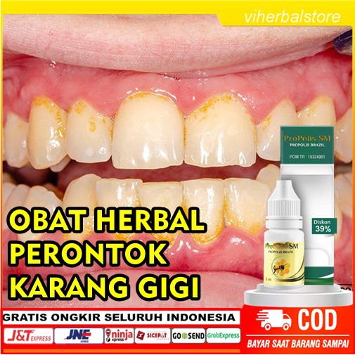 Obat Perontok Karang Gigi Obat Pembersih Karang Gigi Obat Penghancur Karang Gigi Obat Gigi Kuning Shopee Indonesia