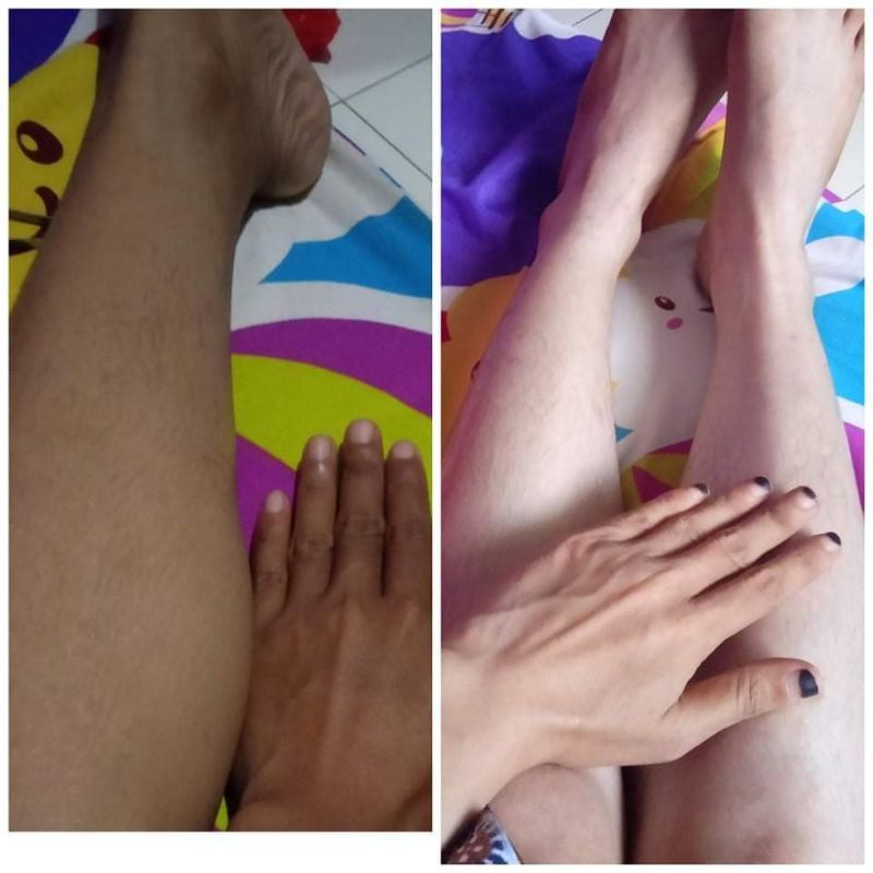 HB UNGU PLATINUM (dosis 4x lebih ceper memutihkan)