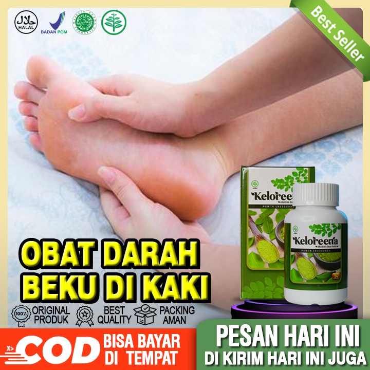 Jual Obat Darah Beku Di Kaki Penghilang Darah Beku Pembekuan Darah Di