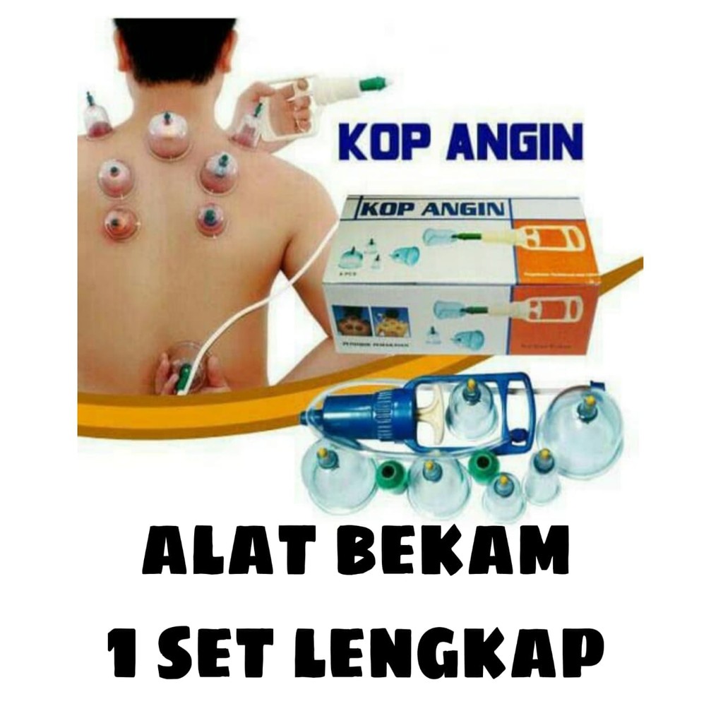 Kop angin isi 6 tabung alat bekam / alat bekam / alat masuk angin / alat penyedot bekam / kop angin