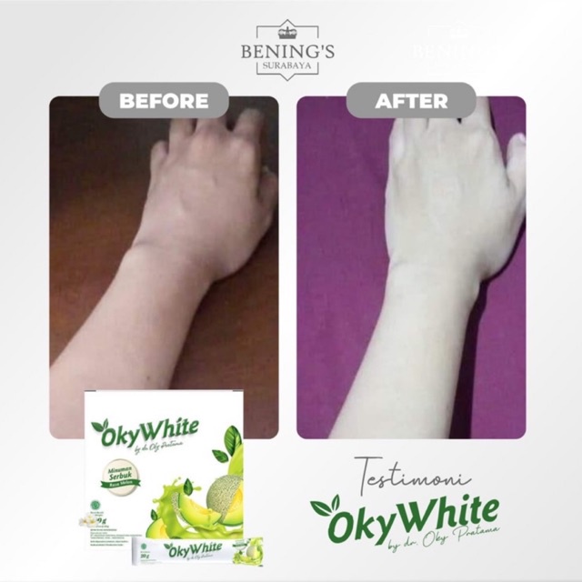 BENING'S OKYWHITE | MEMUTIHKAN &amp; MENCERAHKAN KULIT | BPOM &amp; HALAL | FREE GIFT SIAP KIRIM SELURUH INDONESIA