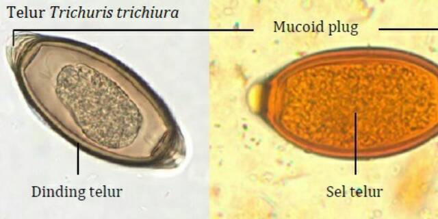 Gambar Telur Cacing Tambang – Pulp