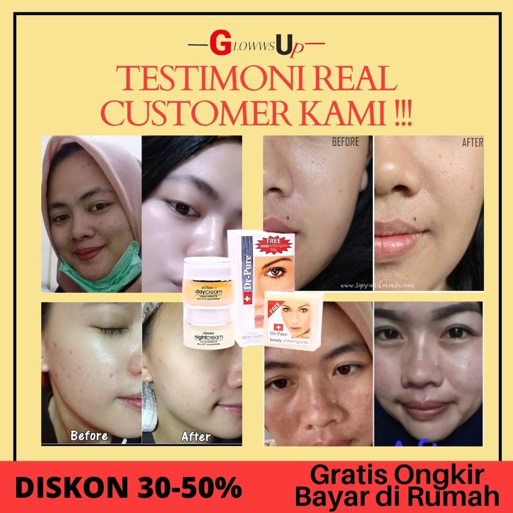 CREAM PENCERAH WAJAH DR PURE SET WHITENING CREAM KRIM SIANG MALAM PERAWATAN WAJAH