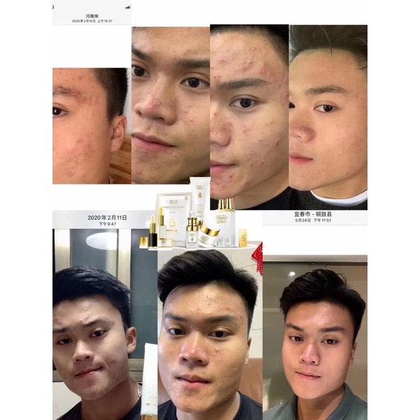 skin care Yan Zheng Tang u dan masalah kulit wajah lain nya, bikin awet muda hilang kan flek, jerawa